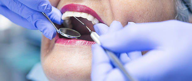Best Dental Abscess Treatment in Griswold, IA